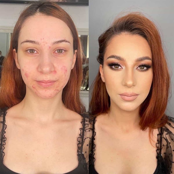 Curs perfectionare machiaj ten acneic